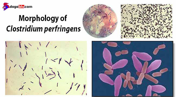 Vi khuẩn Clostridium Perfringens  hình que sợi gây bệnh viêm ruột hoại tử ở gà